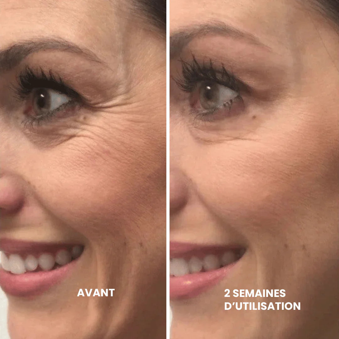 Retinal™ — Soin Lissant Anti-Rides Nouvelle Génération · Visage, Cou & Corps