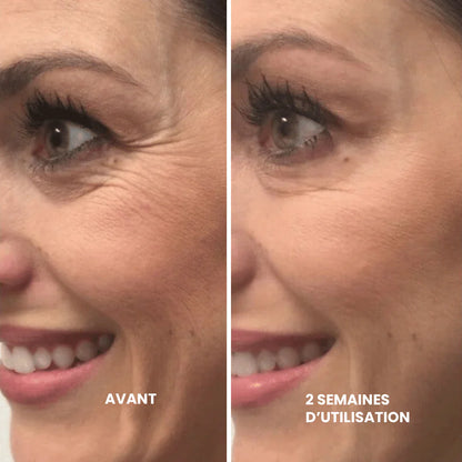 Retinal™ — Soin Lissant Anti-Rides Nouvelle Génération · Visage, Cou & Corps