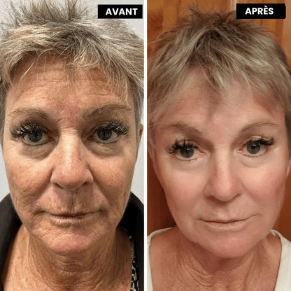 Retinal™ — Soin Lissant Anti-Rides Nouvelle Génération · Visage, Cou & Corps