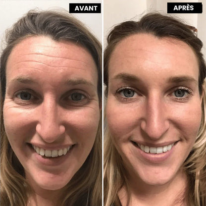 Retinal™ — Soin Lissant Anti-Rides Nouvelle Génération · Visage, Cou & Corps