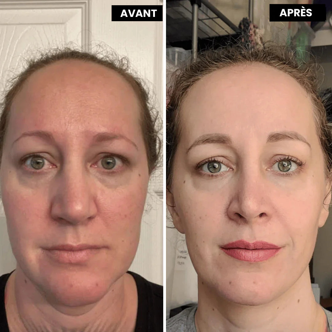 Retinal™ — Soin Lissant Anti-Rides Nouvelle Génération · Visage, Cou & Corps