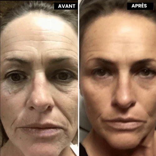 Retinal™ — Soin Lissant Anti-Rides Nouvelle Génération · Visage, Cou & Corps